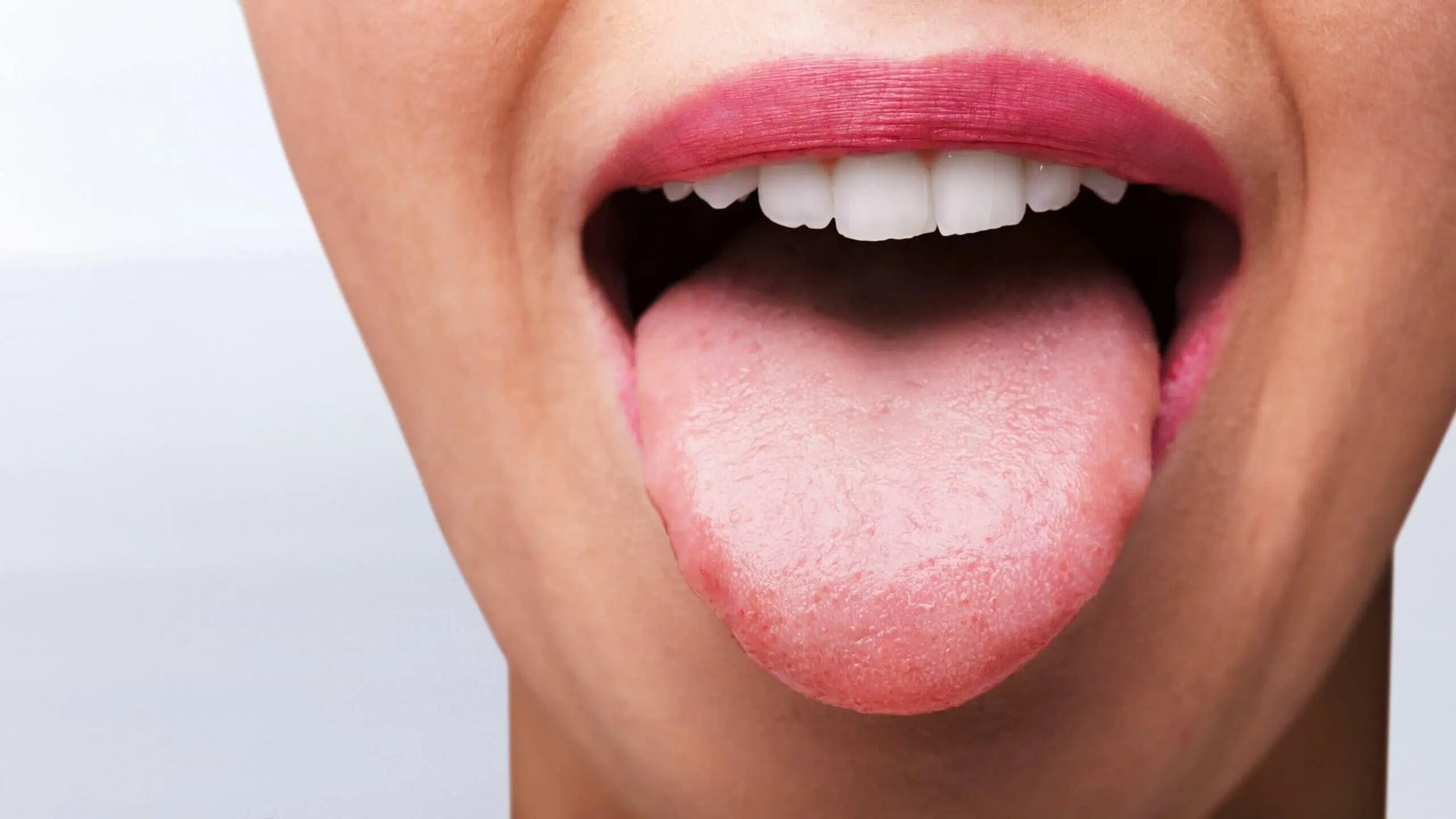 Candida: Why It’s an Immune Problem, Not an Overgrowth Problem